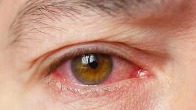  8 natural home remedies that work