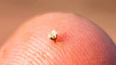 Karnataka boy recovers after yellow paper wasp sting