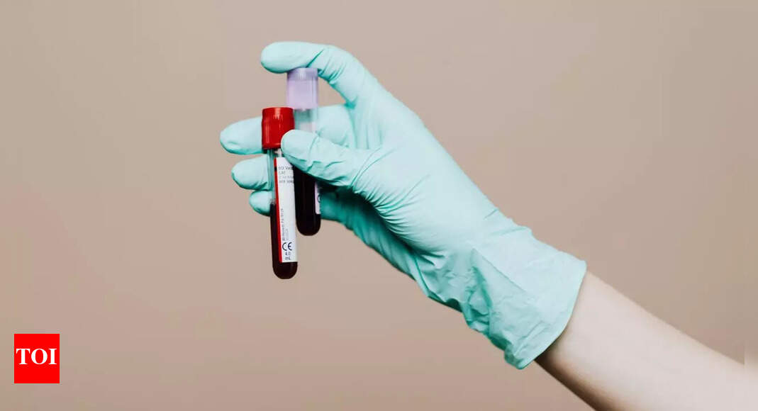 Not just cholesterol: THIS overlooked blood test can signal stroke risk – The Times of India