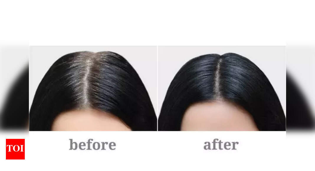Simple hacks to turn your grey hair in black