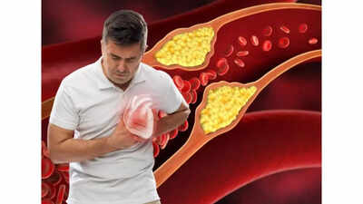  Here’s how to spot CKM and stop this hidden health condition