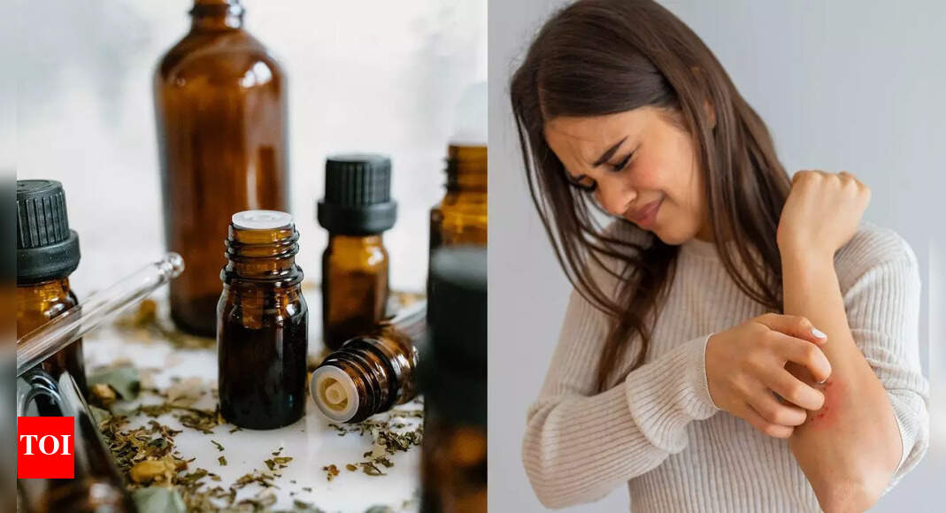 Natural remedies for psoriasis: 5 essential oils that help reduce redness and itching