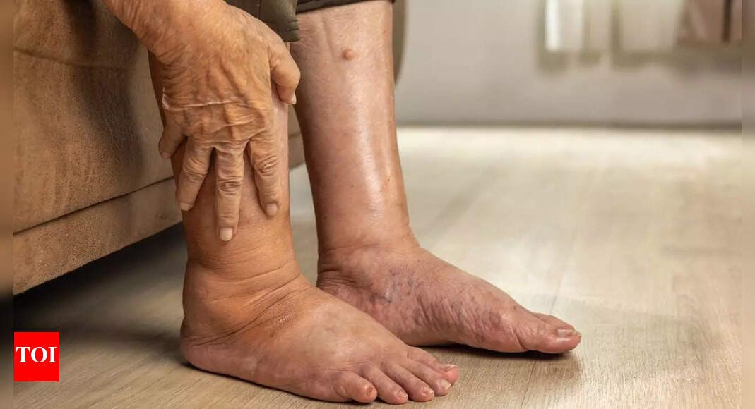 Pancreatic cancer: 4 warning signs in your legs that you shouldn't ignore