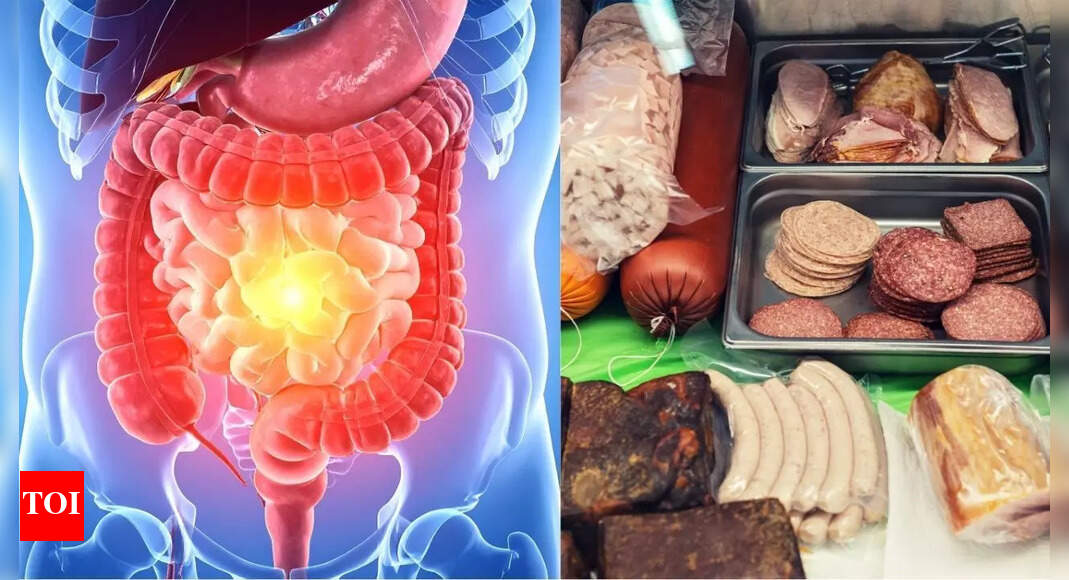 From ice cream to ketchup: These food additives could be secretly damaging your gut