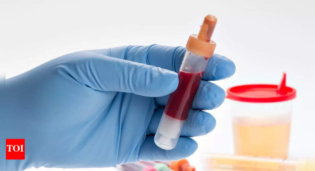 Is blood in urine a sign of kidney cancer? Know the causes, signs, and risk factors