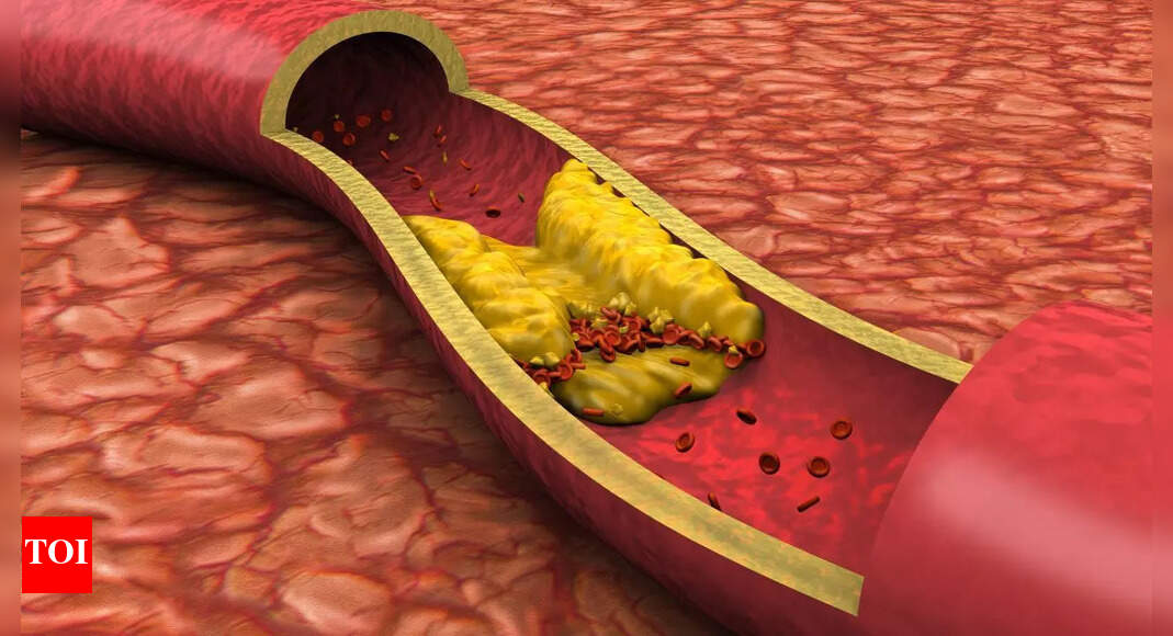 LDL vs. HDL cholesterol: Understanding the key differences, heart disease risk, and natural ways to balance levels