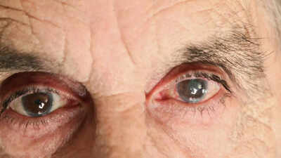 How air pollution affects eye health: Know symptoms, risks, and tips to prevent