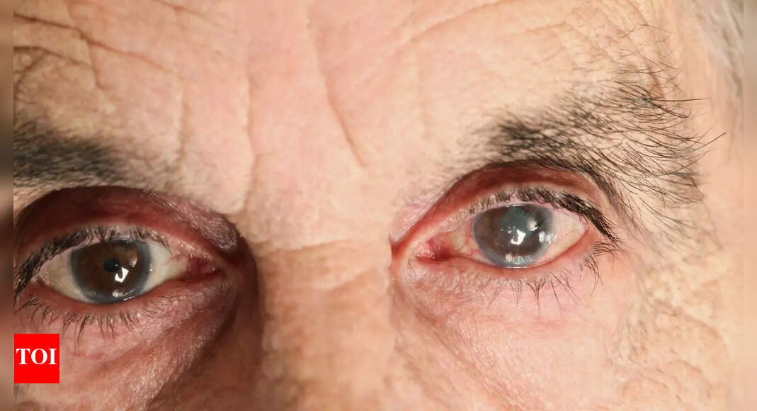 How air pollution affects eye health: Know symptoms, risks, and tips to prevent