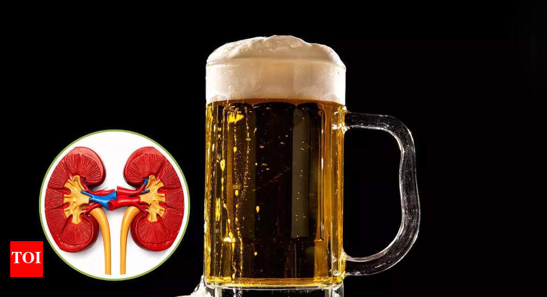 Does drinking beer remove kidney stones? Myths vs. facts