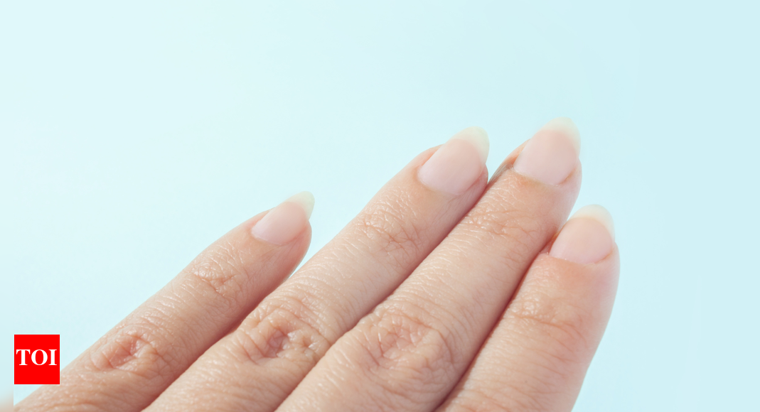 Harvard-trained longevity expert reveals surprising link between nail growth and aging