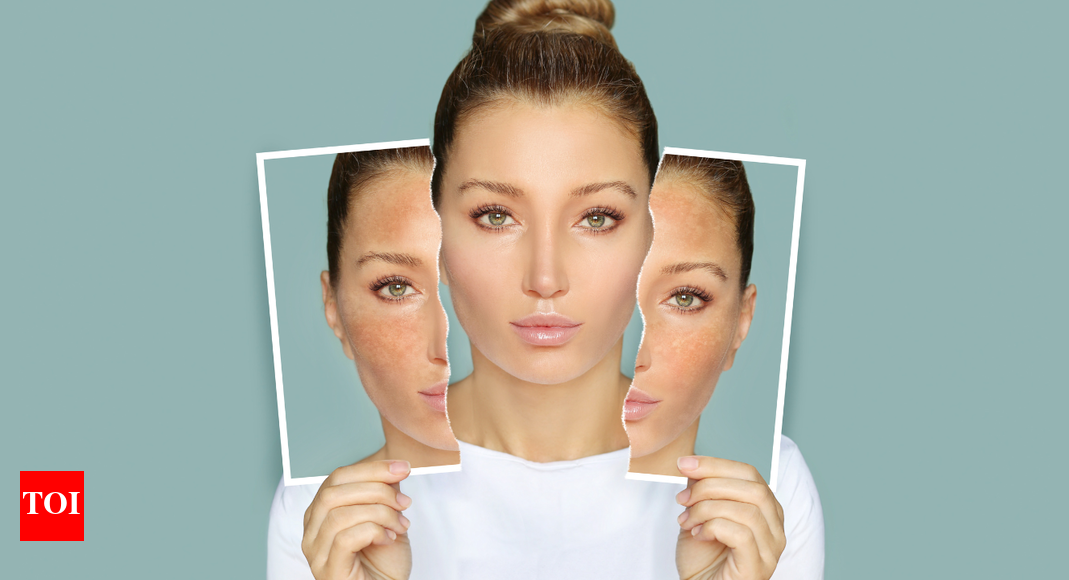 What happens to the skin and complexion if one drinks less amount of water – The Times of India