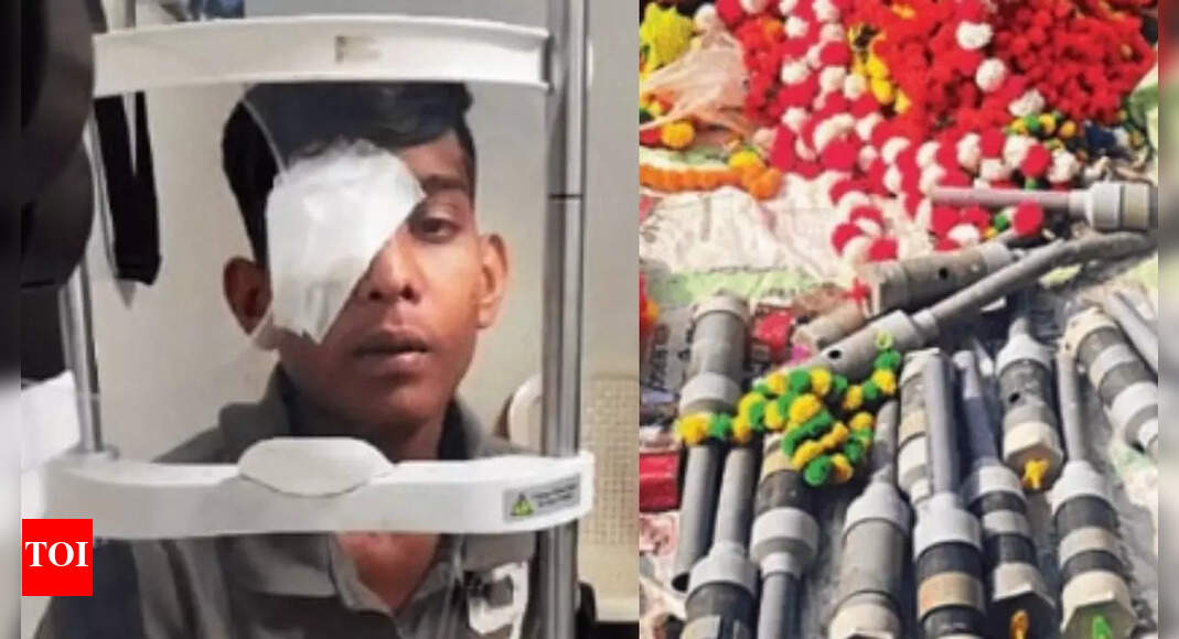 What are carbide guns? Diwali celebrations leave 300 injured in Madhya Pradesh; 30 facing blindness