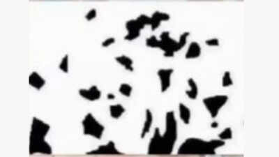  Dancing couple or ink spots? What you notice first reveals this about your stress levels