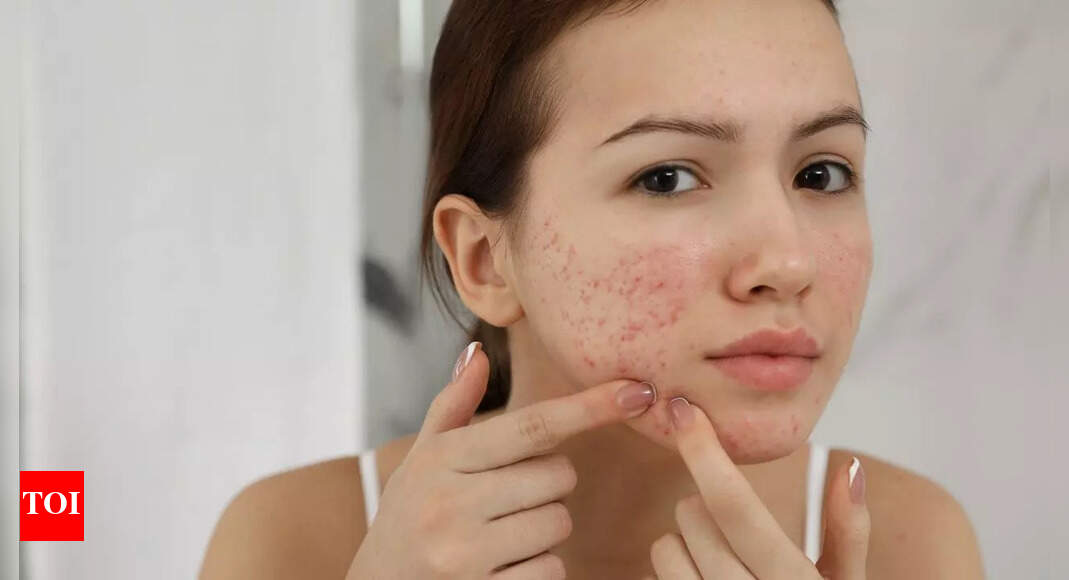 5 home remedies to naturally fade scars and improve skin texture