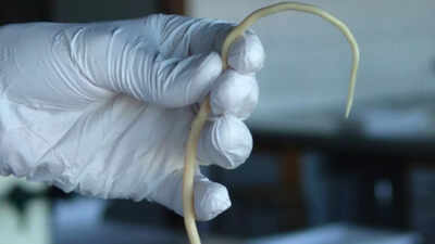 Wikipedia 9 terrifying human parasites that feed on the human body and cause serious health risks