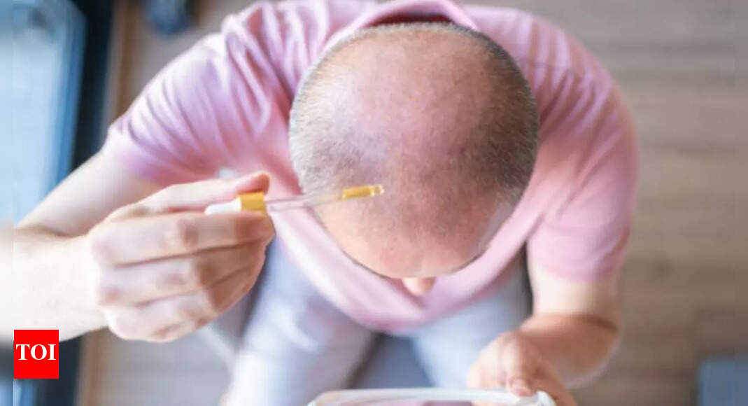 Scientists say they have developed a serum that restores hair in 20 days