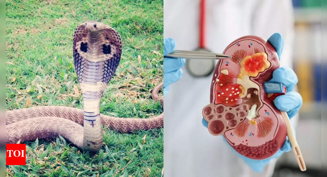 Snake urine could cure kidney stones and gout pain, scientists reveal | – The Times of India Snake urine could cure kidney stones and gout pain, scientists reveal | – The Times of India