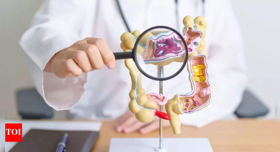 What’s happening to young Americans’ guts? Dangerous colon disease on the rise | - The Times of India