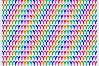 Optical Illusion: Only those with high IQ can find the odd letter among the “Y’s”