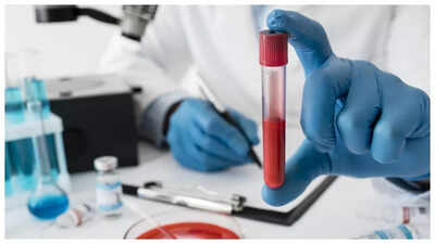 The 3 simple tests that can literally 'save' one’s life, as per Stanford trained doctor