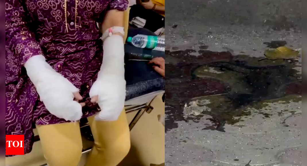 'I kept screaming, but no one stopped to help': DU student attacked with acid near college; stalker, 2 others on the run