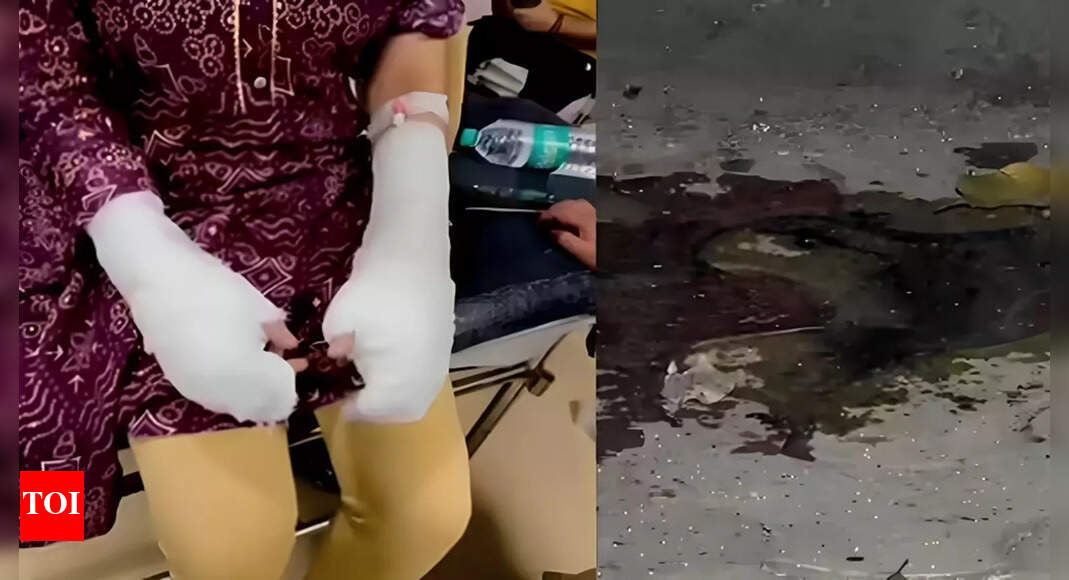 Delhi acid attack case: Suspect was 'miles away'; old rape case against victim’s father adds to the twist