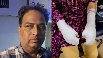 Akil Khan, woman being treated at a hospital after sustaining burn injuries on her hands in the alleged acid attack.  Woman faked assault, used toilet cleaner; father booked for rape