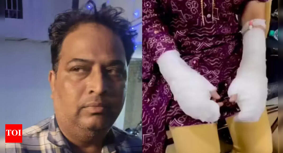 Twist in Delhi acid attack case: DU girl’s father held; cops suspect injuries