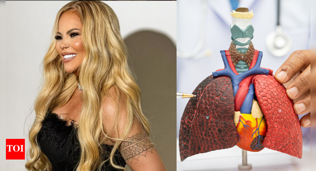 Brazilian singer Vanessa Rios dies at 42 from 'rare lung cancer'; here's everything we know on the condition - The Times of India