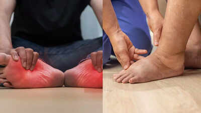 फेफड़ों के कैंसर के शुरुआती लक्षण जो आपके पैरों और टांगों में दिखाई देते हैं: सूजन, दर्द और रंग में बदलाव