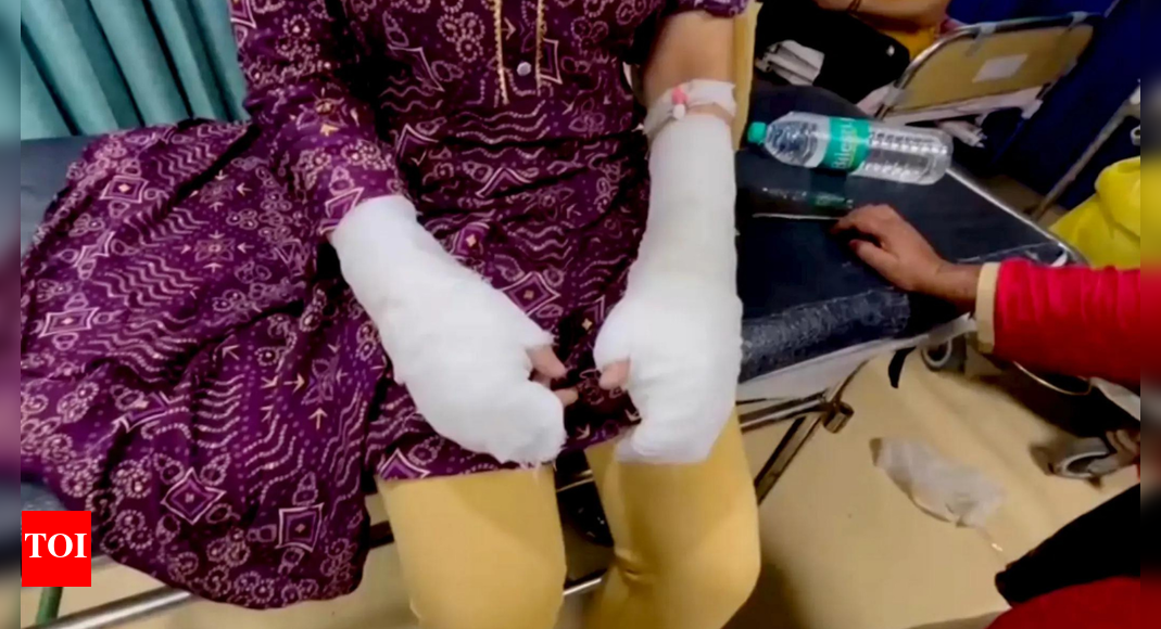 Delhi fake acid attack case: Police arrest uncle, brother of DU student; father alleged mastermind