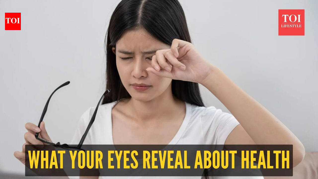 What the eyes say about health: Dietitian decodes 9 warning signs and ...