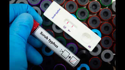 Representative image 1546 scrub typhus cases detected in Sundargarh