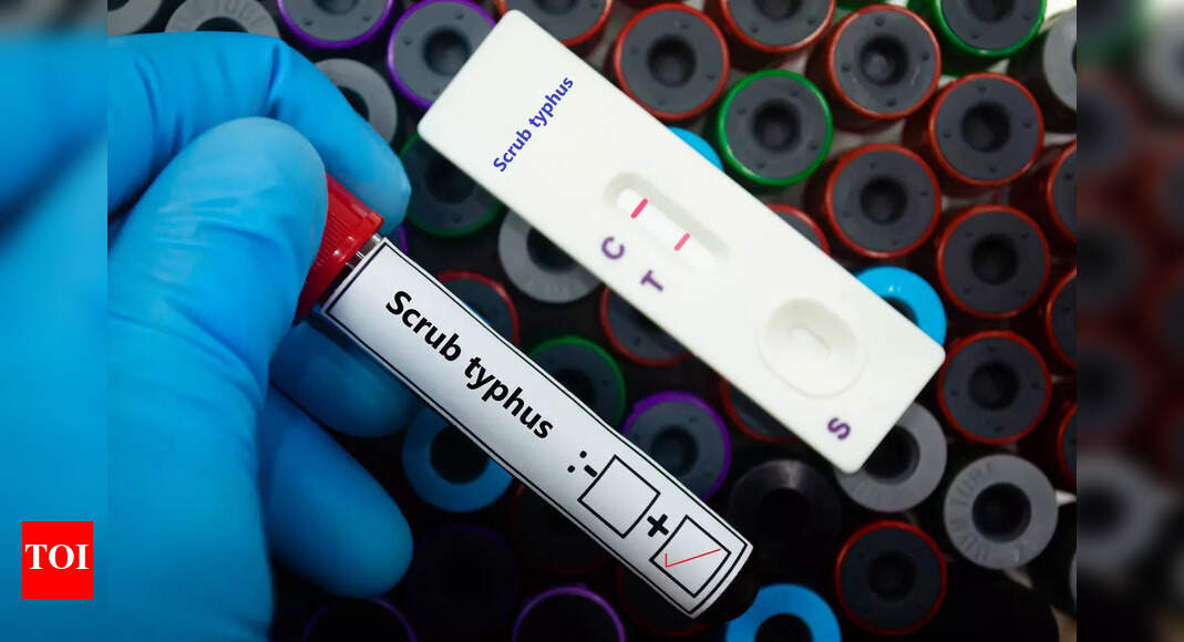 1546 scrub typhus cases detected in Sundargarh