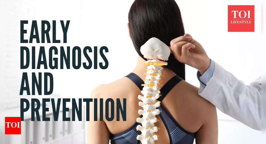 The silent thief of bones: Why osteoporosis is diagnosed too late