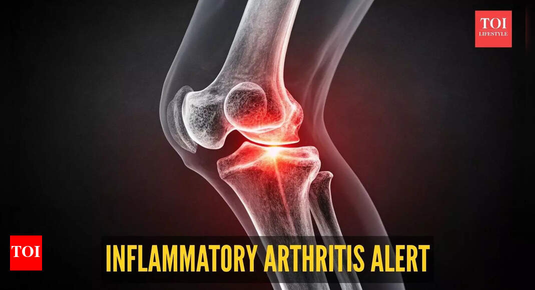 When the body turns against its own joints: Orthopaedic expert explains inflammatory arthritis