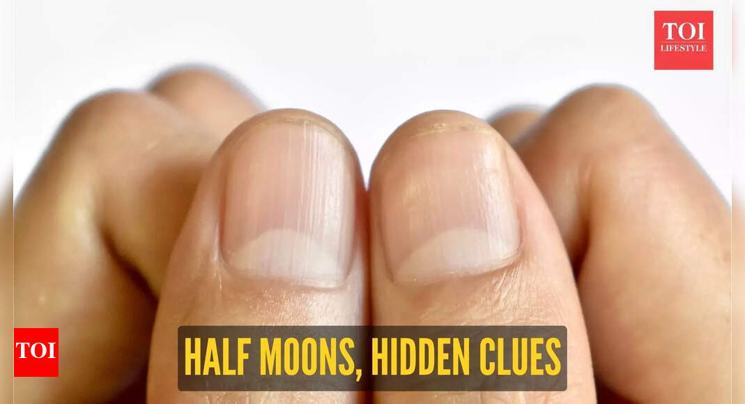 Is the formation of a half moon on the nail a symptom of heart or kidney disease?