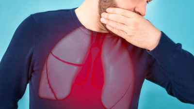 Lung cancer isn’t just a smoker’s disease, say oncologists and warn on early signs this awareness month