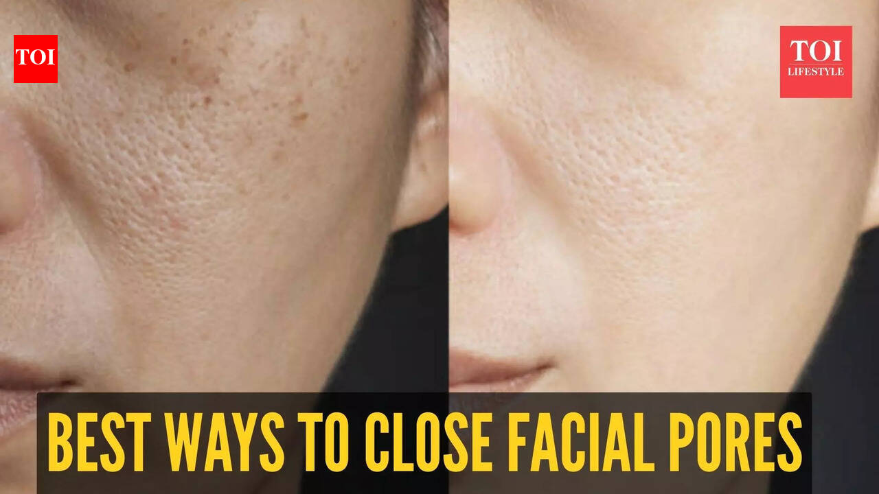 How to close open pores of face