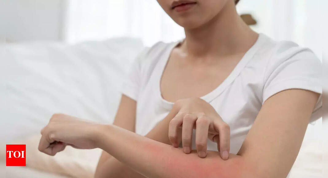 Itchy skin could be a warning sign of kidney disease: What uremic pruritus feels like and how to manage it