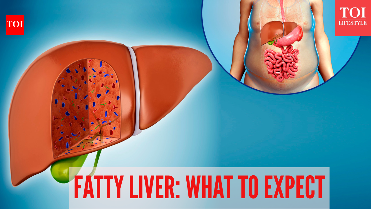 4 stages of fatty liver disease explained: Symptoms, risks, and recovery