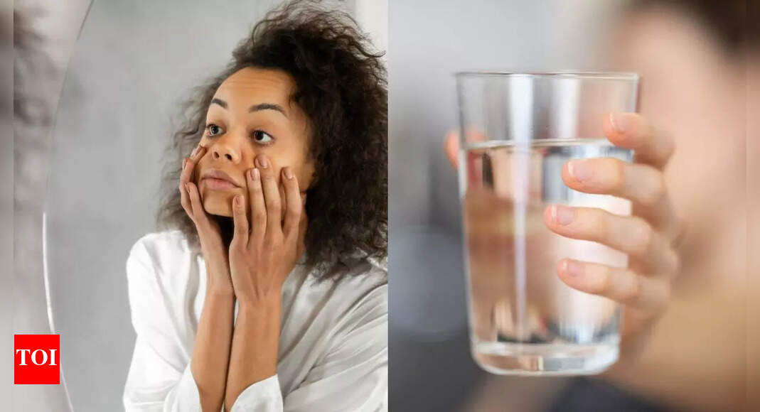 Ingesting much less water could possibly be making your darkish circles worse; right here’s why | – The Instances of India