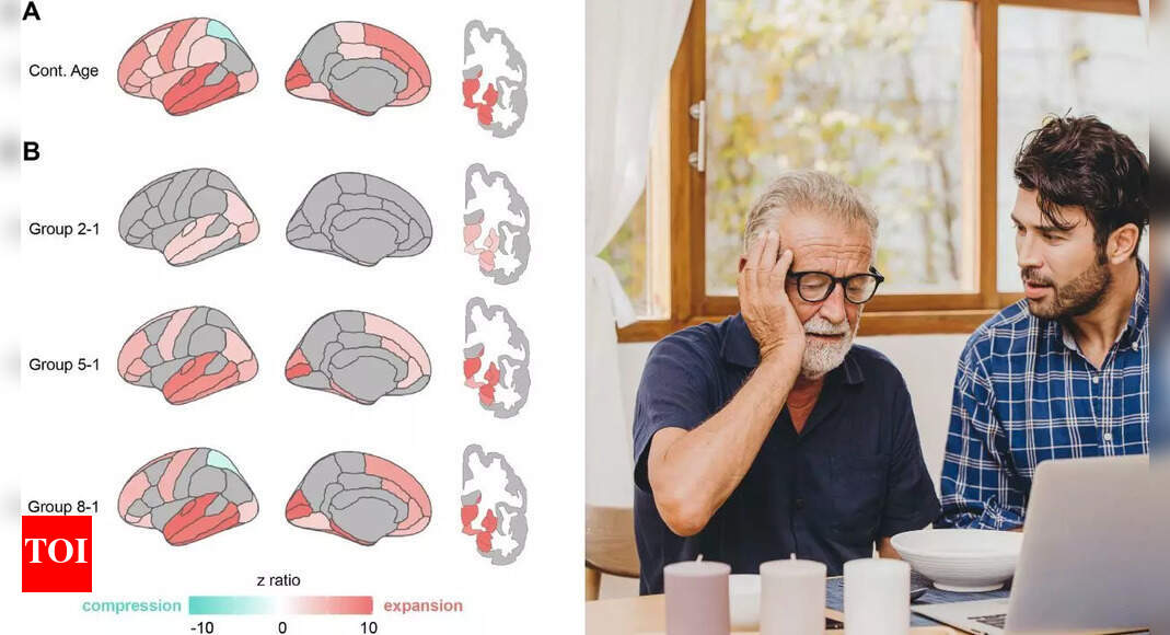 Changes in brain shape may reveal early symptoms of Alzheimer’s and dementia — scientists just discovered how