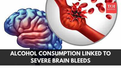  Alcohol consumption linked to severe brain bleeds, study finds