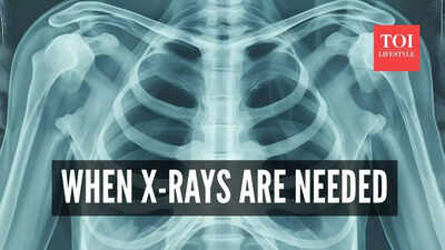  Here’s when they’re actually needed