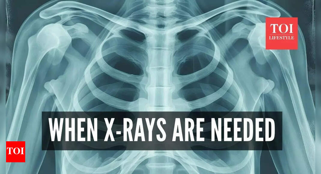 Top neurologist warns, 'stop routine chest X-rays': Here’s when they’re actually needed