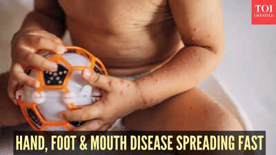  Doctors warn about symptoms, share prevention tips