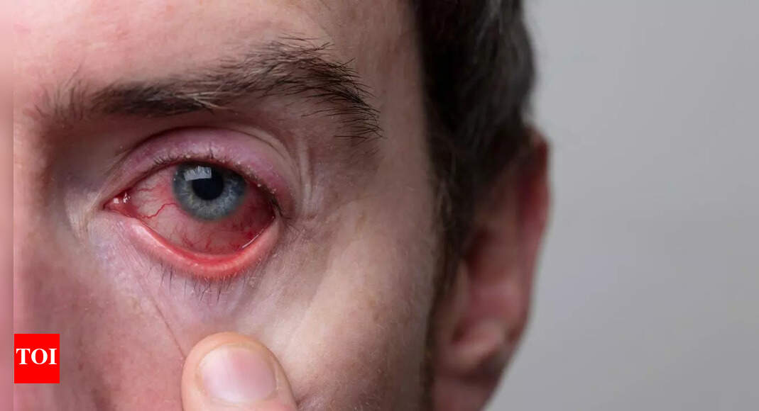 10 hidden health risks your eyes reveal before symptoms appear: Early signs you might be overlooking and prevention tips |