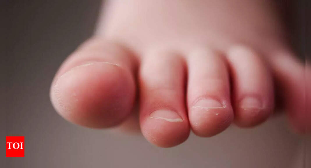 Early warning signs of vitamin B12 deficiency can appear in your toes