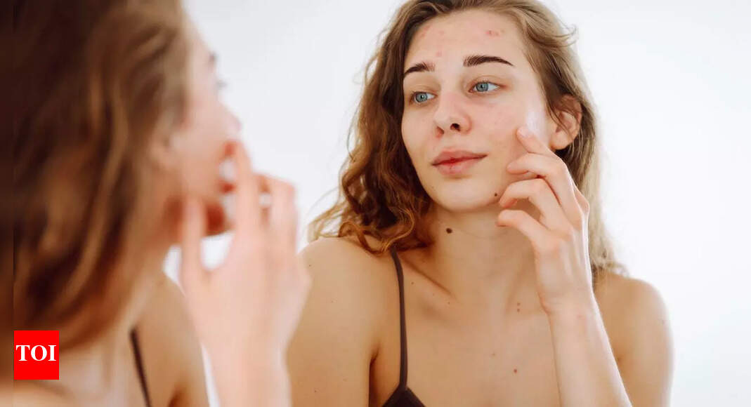Understanding skin fatigue: How lack of sleep and stress affect your skin’s health and appearance